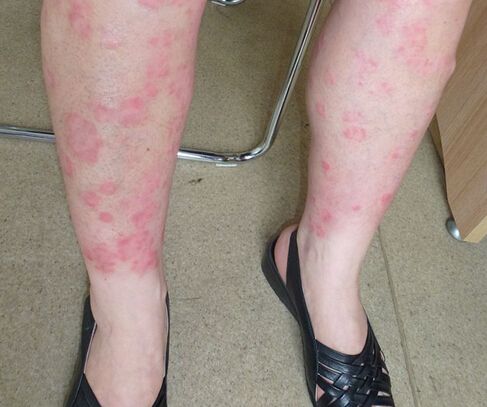 在家跑步有啥好处