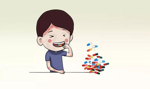 儿童牛皮癣用什么药