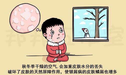 如何做才能不怕银屑病的复发