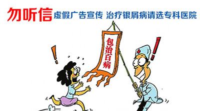 银屑病吃什么药好