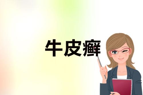 牛皮癣是如何将你吞噬的