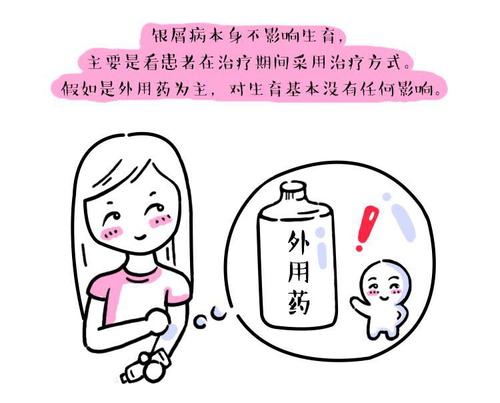 银屑病做哪些检查