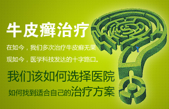 寻常型银屑病不可怕,就看你如何治疗了 寻常型银屑病不可怕,就看你如何治疗了