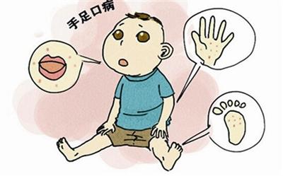 如何清理耳朵里的银屑病