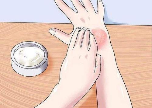 土豆可以治皮肤病吗