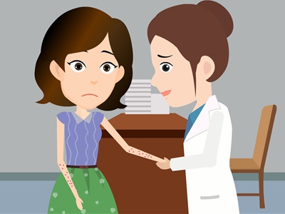 银屑病检查收费项目