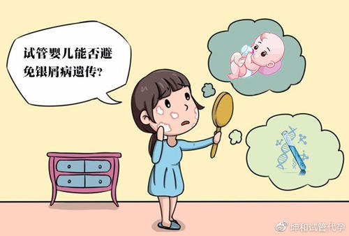 看牛皮癣需要多少钱