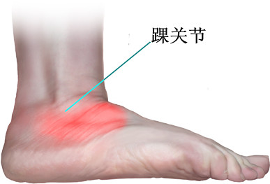 牛皮藓患者踝关节受伤咋办