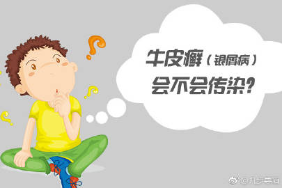 牛皮癣危害是什么