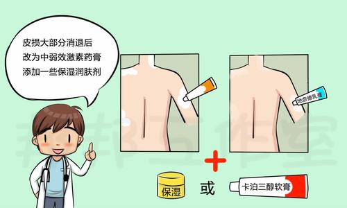 如何辨别牛皮癣