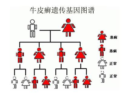 复杂难治的牛皮癣病因有哪些 复杂难治的牛皮癣病因有哪些