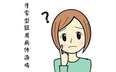 银屑病不治疗会严重吗