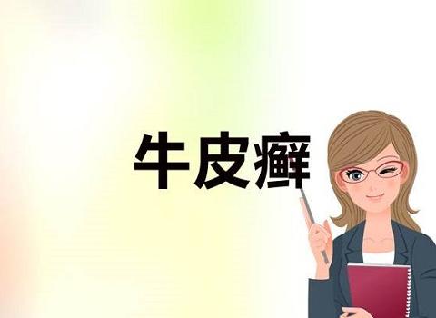 牛皮癣的复发如何预防