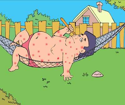 治疗牛皮癣的药物