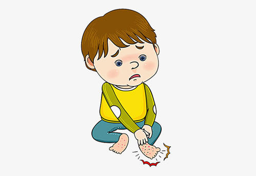 银屑病夏季积极治疗