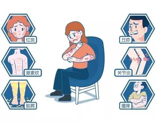 如何预防牛皮癣复发