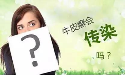 牛皮癣被误认为传染病