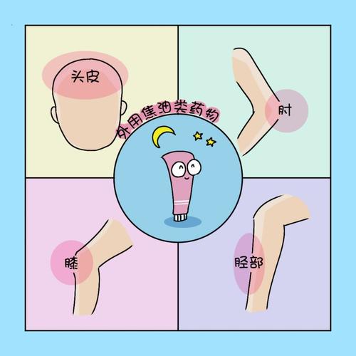 银霄病需要做哪些检查