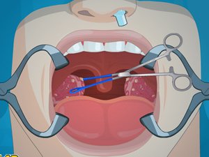 摘了扁桃体牛皮癣还复发吗
